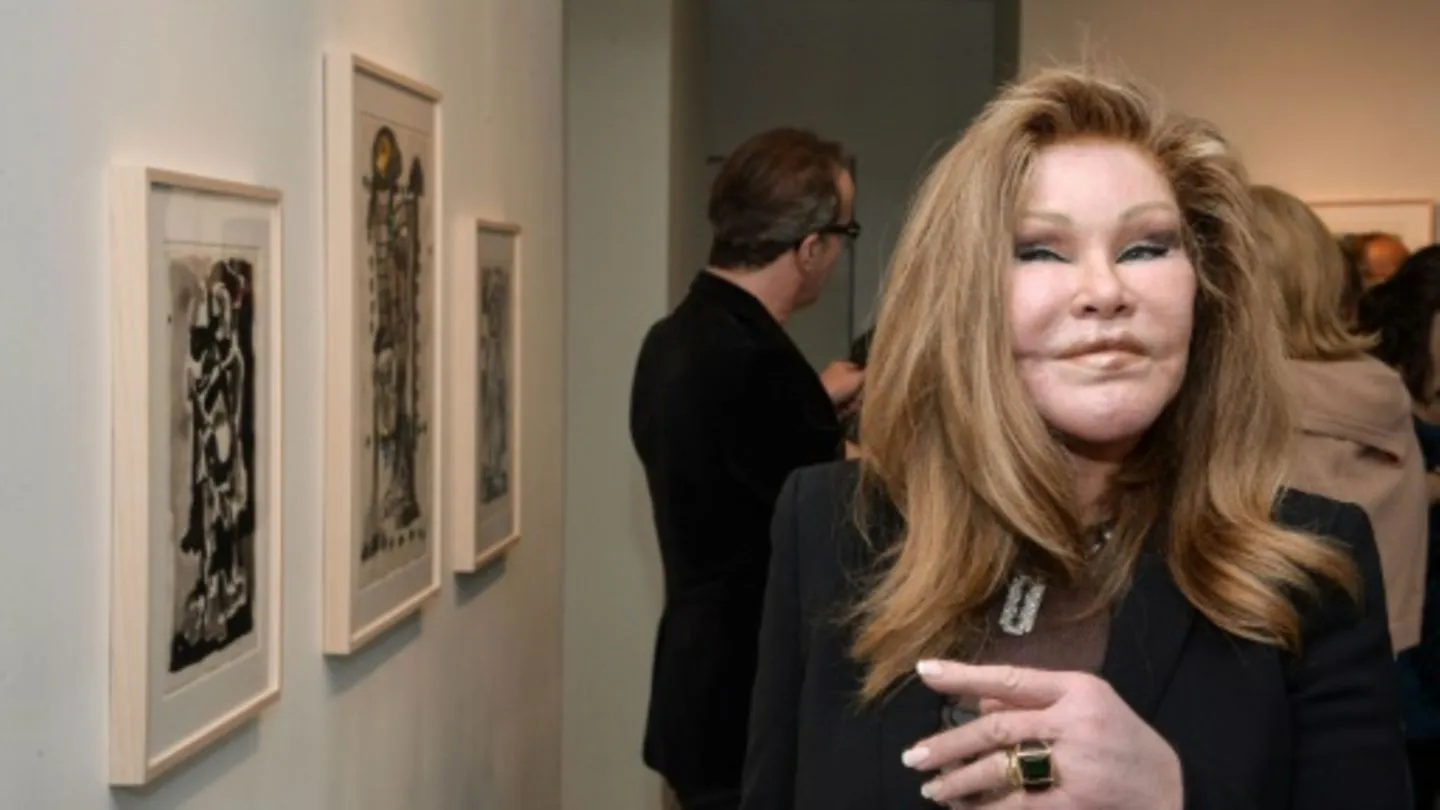 Die Katzenfrau Jocelyn Wildenstein: Skandal, Schönheit und das Geheimnis ihres Erfolgs!