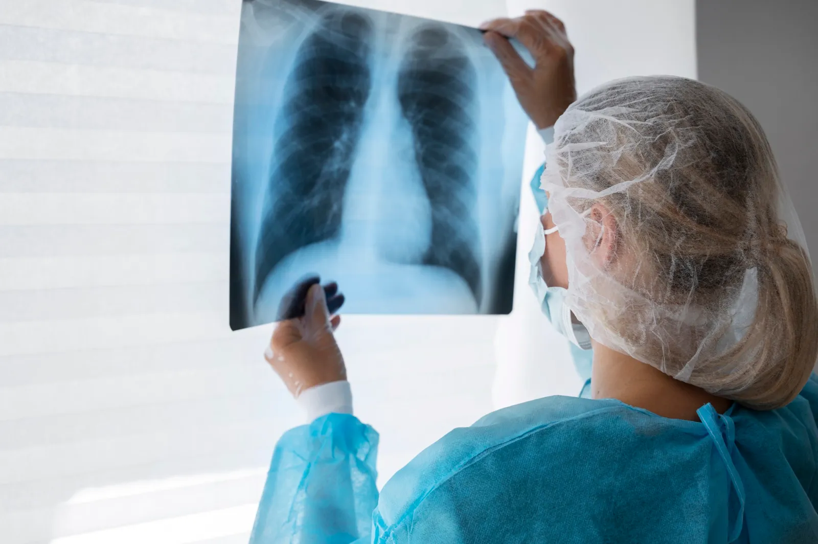 Alarmstufe Rot: Tuberkulose kehrt zurück – Was Sie jetzt wissen müssen!