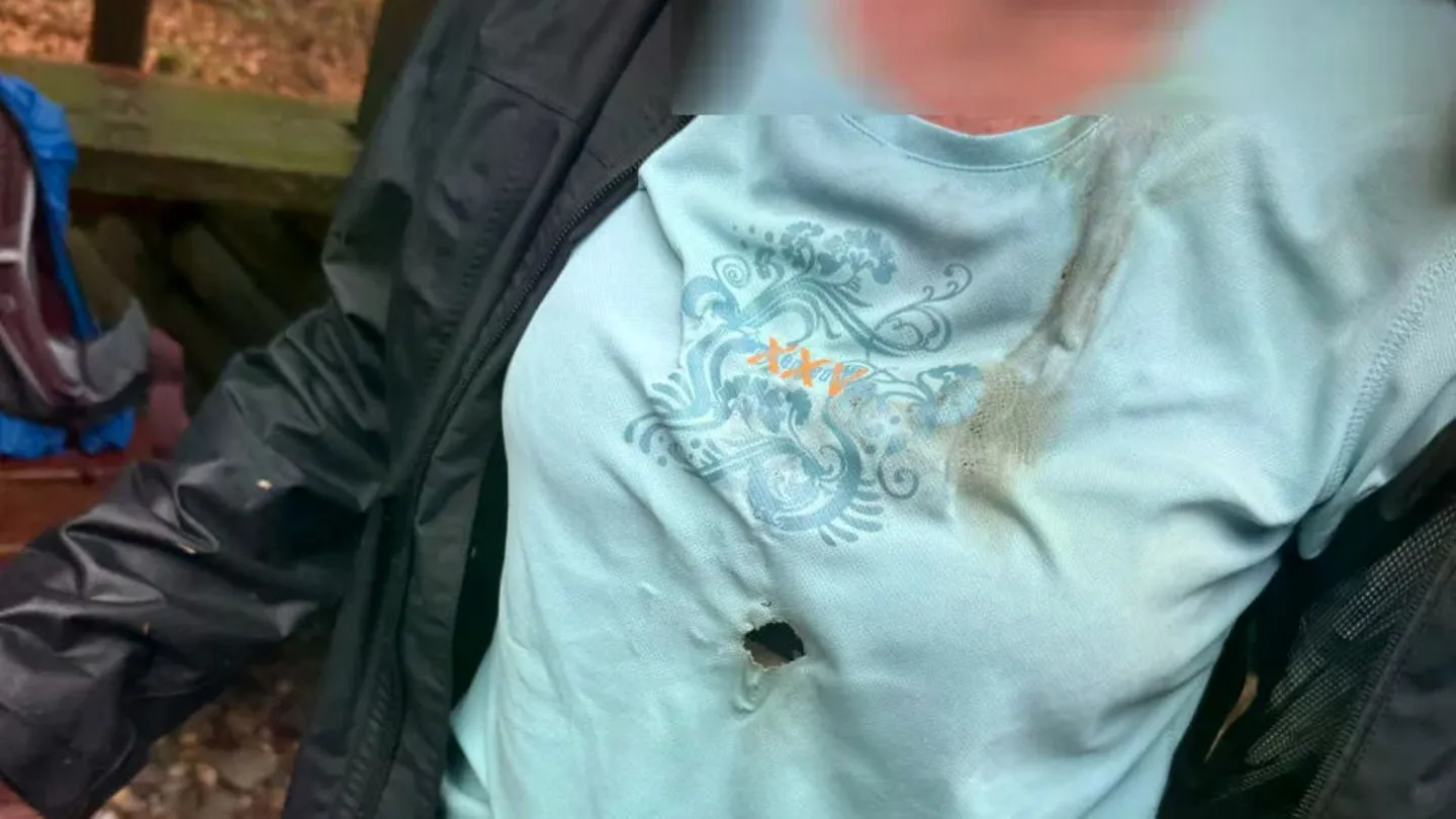Schock in Tschechien: Deutsche Touristen vom Blitz getroffen!